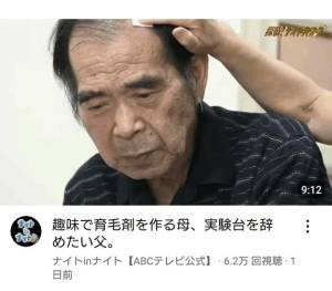 みる 20歳