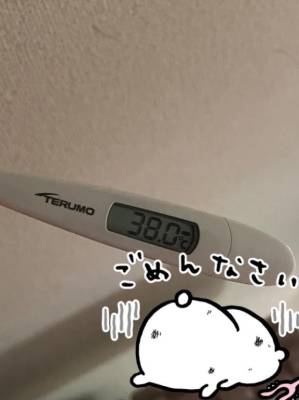 アナ 20歳